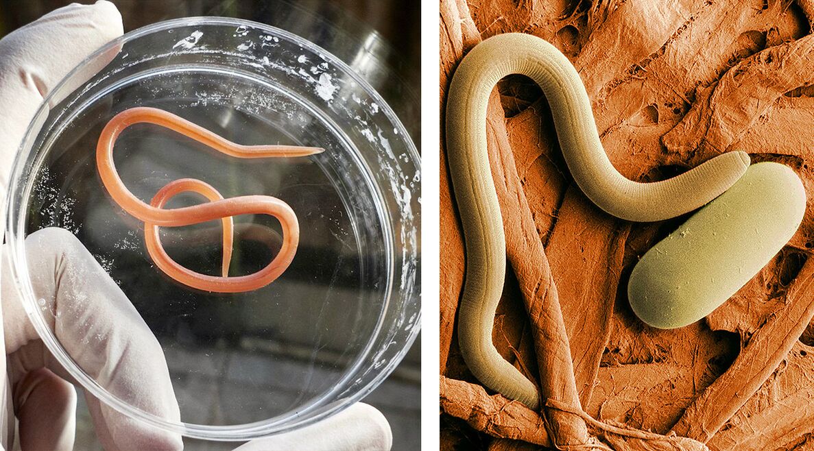 pasożyty w organizmie człowieka